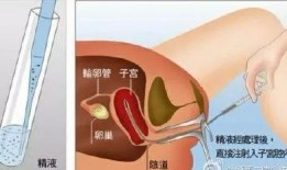 人工授精视频,科技助力生育新篇章